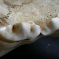 Dentition supérieure