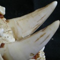 Dentition supérieure