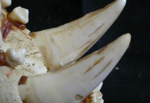 Dentition supérieure