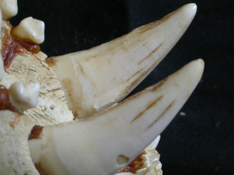 Dentition supérieure