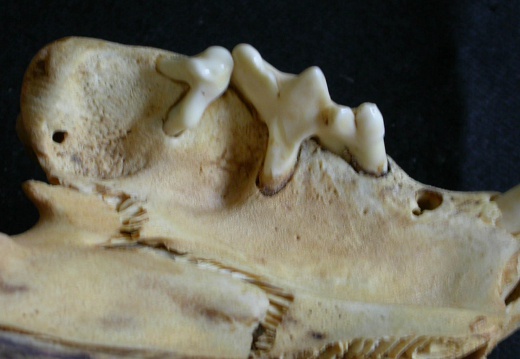 Dentition supérieure