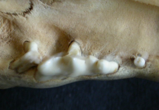 Dentition supérieure