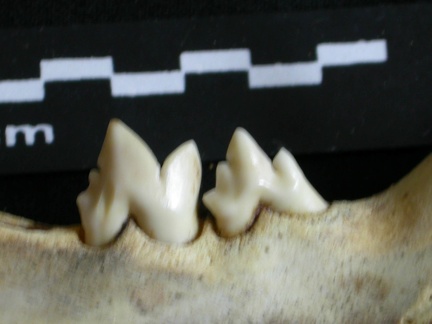 Lower teeth