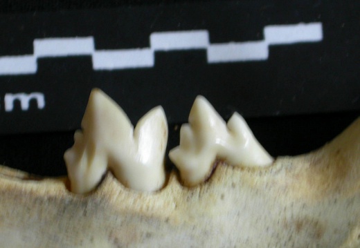 Lower teeth