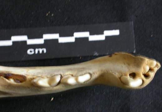 Lower teeth