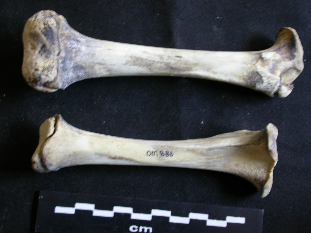  Femur and tibia