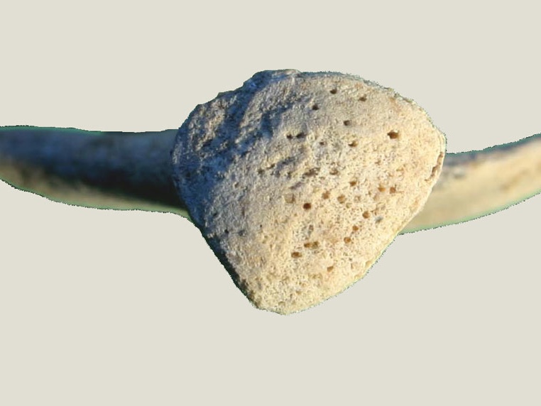 Coxal : cavité acétabulum