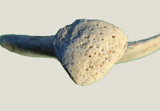 Coxal : cavité acétabulum