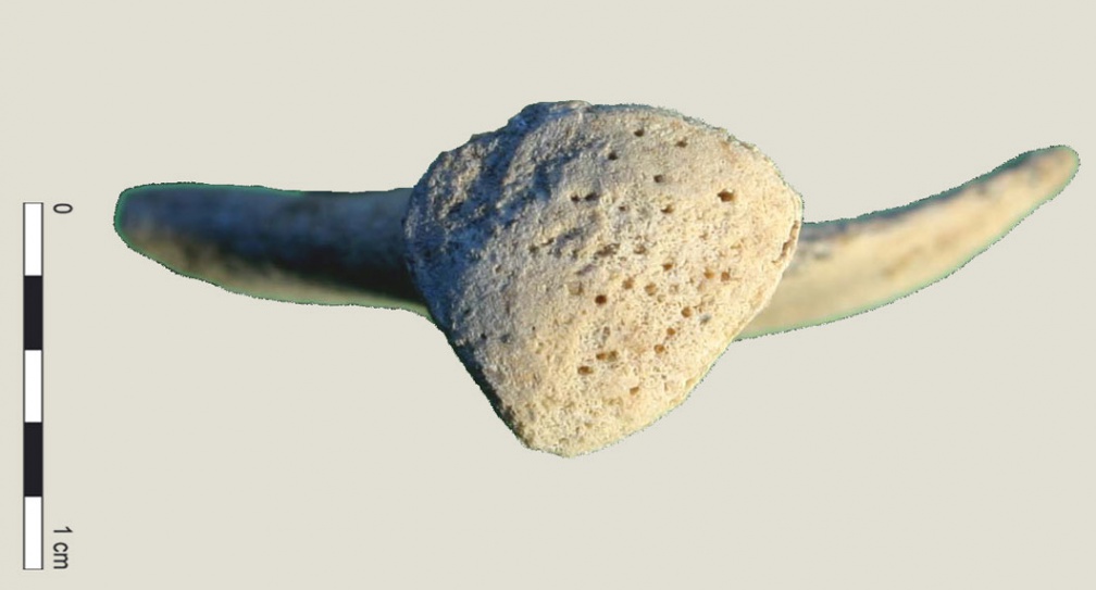 Coxal : cavité acétabulum