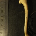 Humerus: medial view