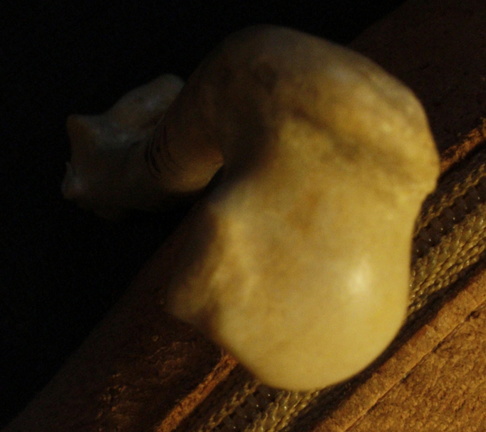 Humérus : extrémité proximale