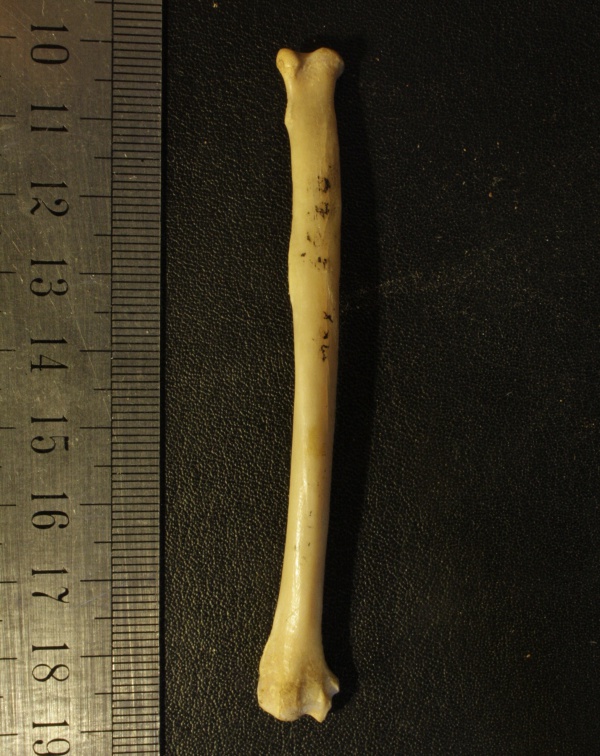 Radius : vue antérieure