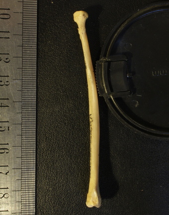 Radius : vue latérale