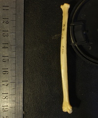 Radius : vue médiale