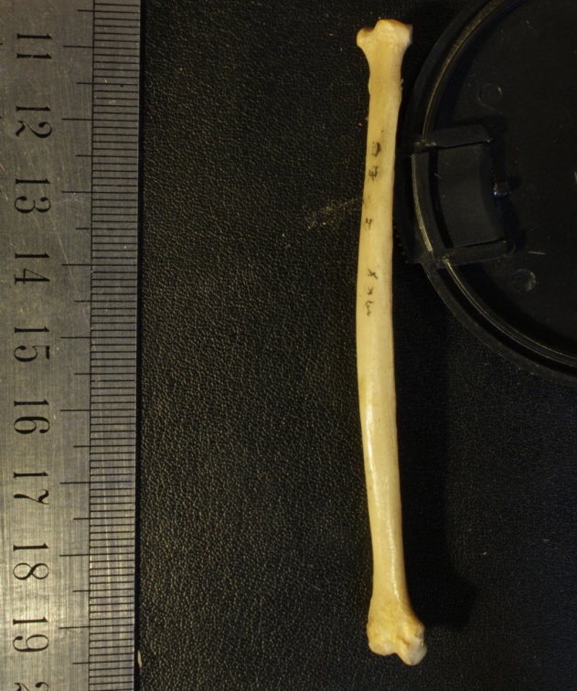 Radius : vue médiale