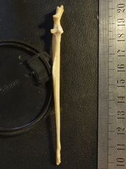 Ulna : vue antérieure