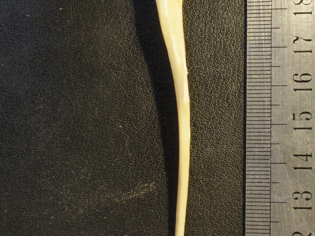 Ulna : vista lateral