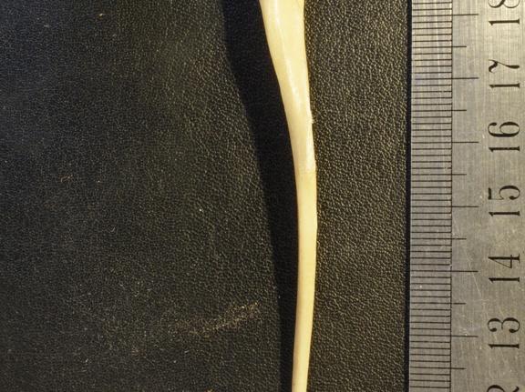 Ulna : vue latérale