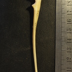 Ulna: medial view