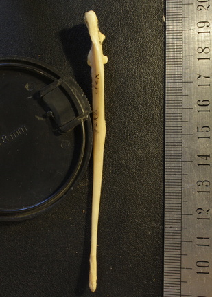 Ulna : vue postérieure