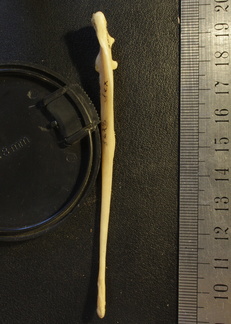 Ulna : vue postérieure