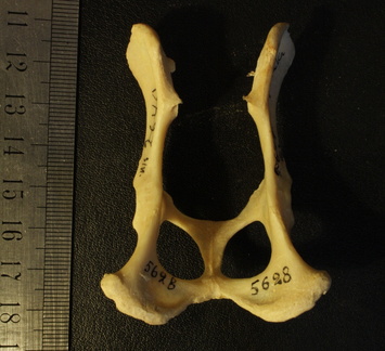 Pelvis : vue dorsale