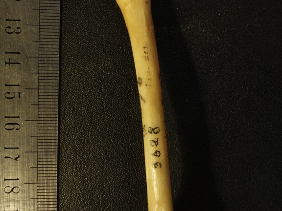 Femur: anterior view