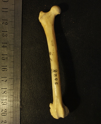 Fémur : vue antérieure