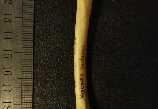 Femur: posterior view