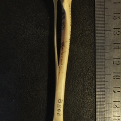 Tibia et fibula : vue antérieure