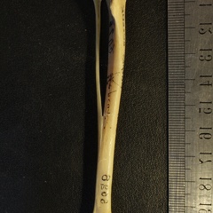 Tibia and fibula: anterior view