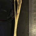 Tibia and fibula: side view