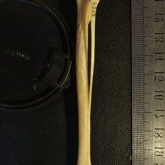 Tibia et fibula : vue postérieure