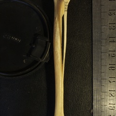 Tibia y fíbula : vista posterior