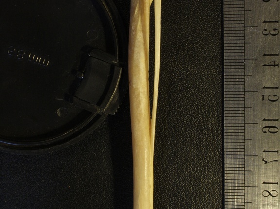 Tibia y fíbula : vista posterior