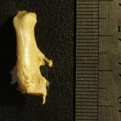 Calcaneus: posterior view