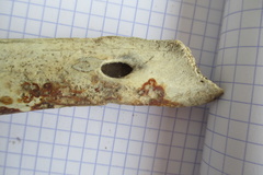 Mand adulte D diastème2