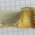 sternum lat (13018 visites) sternum lat