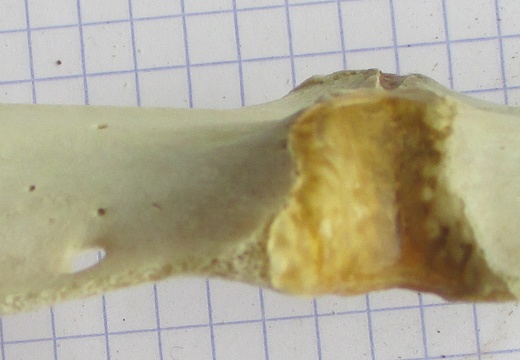 sternum lat (13017 visites) sternum lat