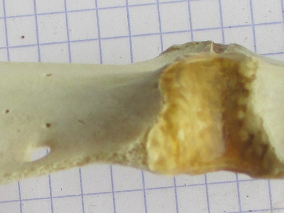 sternum lat (13041 visites) sternum lat