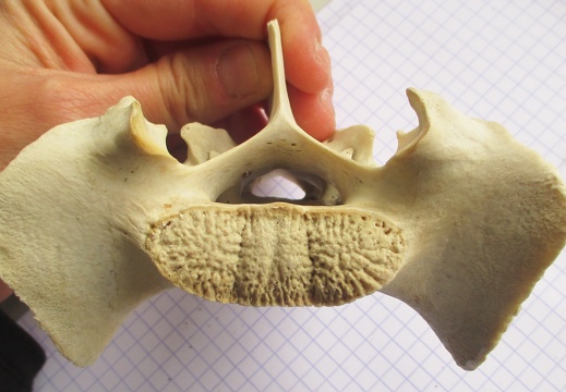 Sacrum cran (13224 visites) Sacrum cran