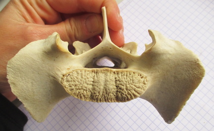 Sacrum cran