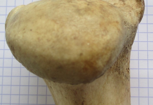 Hum D prox caud1 (11188 visites) Hum D prox caud1