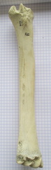 Radius G palm1