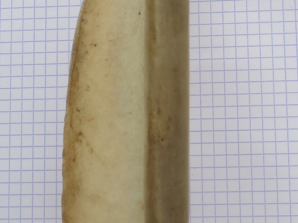 Scapula G caud (14916 visites) Scapula G caud