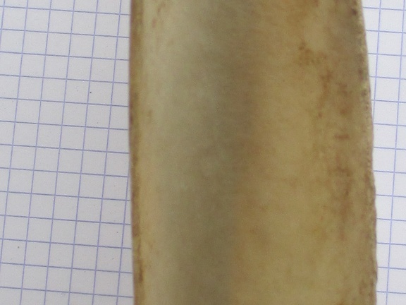 Scapula G cran (15397 visites) Scapula G cran