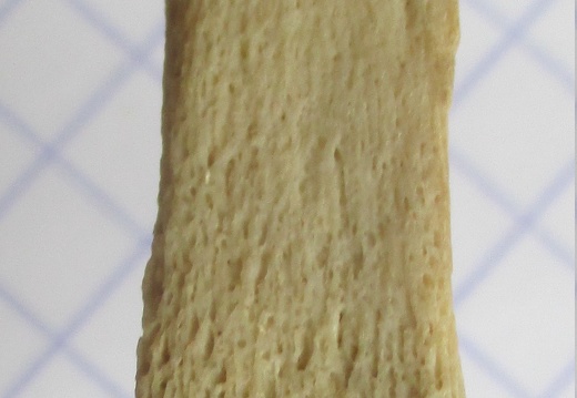 Ulna G dist