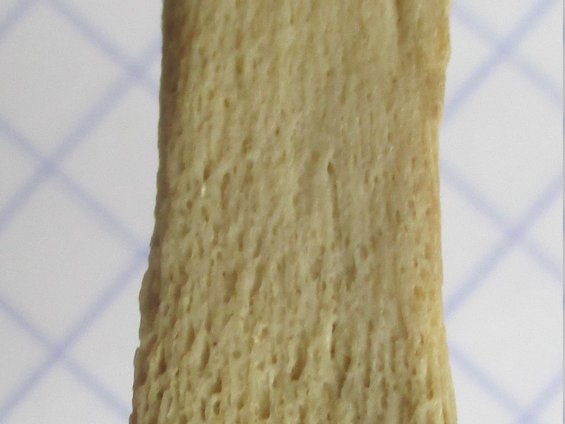 Ulna G dist (15801 visites) Ulna G dist
