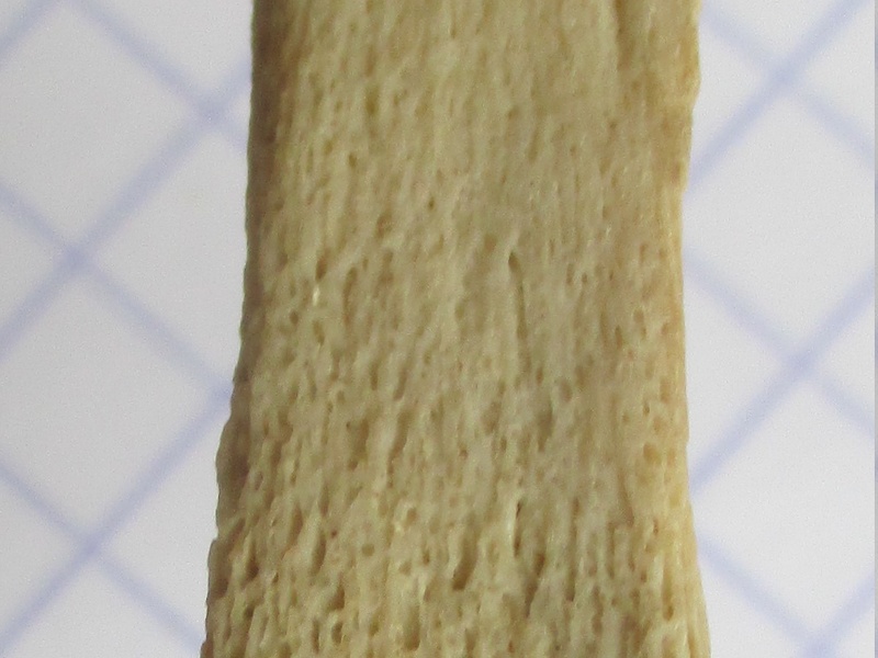 Ulna G dist