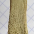 Ulna G dist
